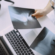 Nowoczesna Diagnostyka Obrazowa w Gorlicach – Kompleksowa Opieka dla Pacjenta Nowoczesna Diagnostyka Obrazowa w Gorlicach – Kompleksowa Opieka dla Pacjenta